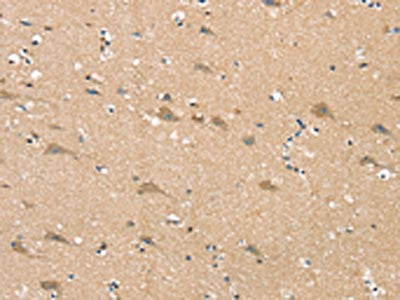 The image on the left is immunohistochemistry of paraffin-embedded Human brain tissue using CSB-PA088132(SGPL1 Antibody) at dilution 1/25, on the right is treated with synthetic peptide. (Original magnification: ×200)