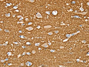 The image on the left is immunohistochemistry of paraffin-embedded Human brain tissue using CSB-PA088228(STXBP1 Antibody) at dilution 1/20, on the right is treated with fusion protein. (Original magnification: ×200)
