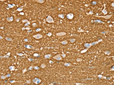The image on the left is immunohistochemistry of paraffin-embedded Human brain tissue using CSB-PA088228(STXBP1 Antibody) at dilution 1/20, on the right is treated with fusion protein. (Original magnification: ×200)