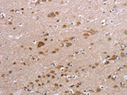 The image on the left is immunohistochemistry of paraffin-embedded Human brain tissue using CSB-PA088329(PPP2R3C Antibody) at dilution 1/30, on the right is treated with fusion protein. (Original magnification: ×200)