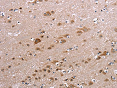 The image on the left is immunohistochemistry of paraffin-embedded Human brain tissue using CSB-PA088329(PPP2R3C Antibody) at dilution 1/30, on the right is treated with fusion protein. (Original magnification: ×200)