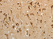 The image on the left is immunohistochemistry of paraffin-embedded Human brain tissue using CSB-PA088395(HSP90B1 Antibody) at dilution 1/50, on the right is treated with fusion protein. (Original magnification: ×200)