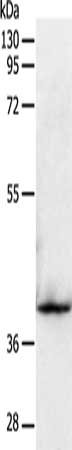 Gel: 10%SDS-PAGE, Lysate: 40 ug, Lane: Mouse heart tissue, Primary antibody: CSB-PA088519(SIRT2 Antibody) at dilution 1/350, Secondary antibody: Goat anti rabbit IgG at 1/8000 dilution, Exposure time: 30 seconds