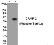 Western blot analysis of extracts from HuvEc cells (Lane 2), using CRMP-2 (Phospho-Ser522) Antibody. The lane on the left is treated with antigen-specific peptide.