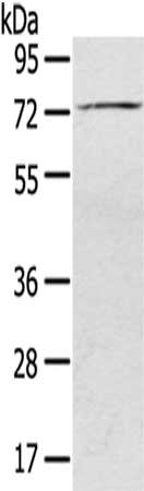 Gel: 8%SDS-PAGE,Lysate: 40 ug,,Primary antibody: CSB-PA088799(SLC27A5 Antibody) at dilution 1/200 dilution,Secondary antibody: Goat anti rabbit IgG at 1/8000 dilution,Exposure time: 1 minute