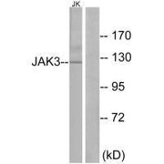 Western blot analysis of extracts from Jurkat cells, using JAK3 (Ab-785) antibody.