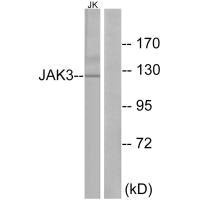 Western blot analysis of extracts from Jurkat cells, using JAK3 (Ab-785) antibody.