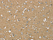 The image on the left is immunohistochemistry of paraffin-embedded Human brain tissue using CSB-PA088870(ATP2A3 Antibody) at dilution 1/30, on the right is treated with synthetic peptide. (Original magnification: ×200)