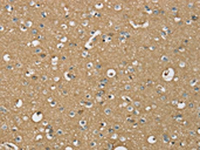 The image on the left is immunohistochemistry of paraffin-embedded Human brain tissue using CSB-PA088870(ATP2A3 Antibody) at dilution 1/30, on the right is treated with synthetic peptide. (Original magnification: ×200)