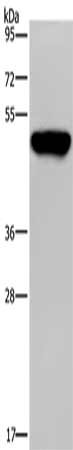Gel: 8%SDS-PAGE, Lysate: 40 ug, Lane: Mouse kidney tissue, Primary antibody: CSB-PA089480(PSMD11 Antibody) at dilution 1/200, Secondary antibody: Goat anti rabbit IgG at 1/8000 dilution, Exposure time: 1 minute