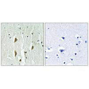 Immunohistochemistry analysis of paraffin-embedded human brain tissue using PAK1/2/3 (Ab-423/402/421) antiobdy.