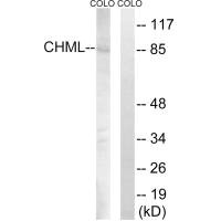 Western blot analysis of extracts from COLO cells, using CHML antibody.