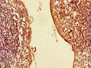 Immunohistochemistry of paraffin-embedded human tonsil tissue using CSB-PA08999A0Rb at dilution of 1:100