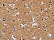 The image on the left is immunohistochemistry of paraffin-embedded Human brain tissue using CSB-PA090179(CBY1 Antibody) at dilution 1/60, on the right is treated with fusion protein. (Original magnification: ×200)