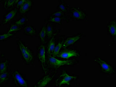 Immunofluorescent analysis of Hela cells using CSB-PA09047A0Rb at dilution of 1:100 and Alexa Fluor 488-congugated AffiniPure Goat Anti-Rabbit IgG(H+L)