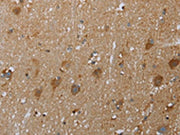 The image on the left is immunohistochemistry of paraffin-embedded Human brain tissue using CSB-PA090550(COX6B2 Antibody) at dilution 1/50, on the right is treated with fusion protein. (Original magnification: ×200)