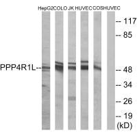 Western blot analysis of extracts from HepG2 cells, COLO cells, Jurkat cells, HUVEC cells and COS cells, using PPP4R1L antibody.