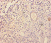 Immunohistochemistry of paraffin-embedded human kidney tissue using CSB-PA09069A0Rb at dilution of 1:100