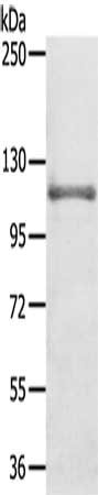 Gel: 6%SDS-PAGE, Lysate: 40 ug, Lane: Mouse kidney tissue, Primary antibody: CSB-PA090803(CNTROB Antibody) at dilution 1/250, Secondary antibody: Goat anti rabbit IgG at 1/8000 dilution, Exposure time: 40 seconds