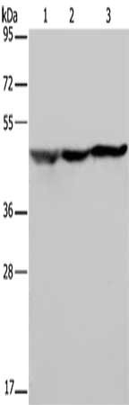 Gel: 8%SDS-PAGE, Lysate: 40 ug, Lane 1-3: HT29 cells, Hela cells, 293T cells, Primary antibody: CSB-PA090980(NUSAP1 Antibody) at dilution 1/200, Secondary antibody: Goat anti rabbit IgG at 1/8000 dilution, Exposure time: 20 seconds