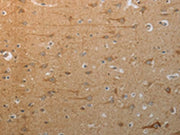 The image on the left is immunohistochemistry of paraffin-embedded Human brain tissue using CSB-PA091224(SLC4A7 Antibody) at dilution 1/50, on the right is treated with synthetic peptide. (Original magnification: ×200)