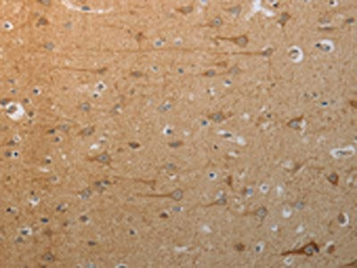 The image on the left is immunohistochemistry of paraffin-embedded Human brain tissue using CSB-PA091224(SLC4A7 Antibody) at dilution 1/50, on the right is treated with synthetic peptide. (Original magnification: ×200)