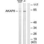 Western blot analysis of extracts from mouse heart cells and Jurkat cells, using AKAP8 antibody.