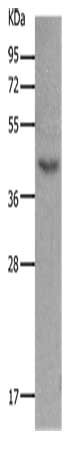 Gel: 12%SDS-PAGE, Lysate: 30 ug, Lane: Mouse muscle tissue, Primary antibody: CSB-PA091719(MC5R Antibody) at dilution 1/1200, Secondary antibody: Goat anti rabbit IgG at 1/8000 dilution, Exposure time: 40 seconds