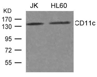Western blot analysis of extract from JK, HL-60 cells using CD11c Antibody