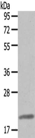 Gel: 10%SDS-PAGE,Lysate: 40 ug,,Primary antibody: CSB-PA092060(CLDN7 Antibody) at dilution 1/200 dilution,Secondary antibody: Goat anti rabbit IgG at 1/8000 dilution,Exposure time: 1 minute