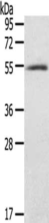 Gel: 8%SDS-PAGE, Lysate: 60 ug, Lane: Human normal stomach tissue, Primary antibody: CSB-PA092457(BAG4 Antibody) at dilution 1/200, Secondary antibody: Goat anti rabbit IgG at 1/8000 dilution, Exposure time: 7 minutes