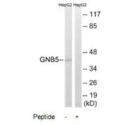 Western blot analysis of extracts from HepG2 cells, using GNB5 antibody.