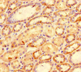 Immunohistochemistry of paraffin-embedded human kidney tissue using CSB-PA09289A0Rb at dilution of 1:100