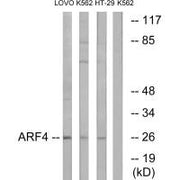 Western blot analysis of extracts from LOVO cells, K562 cells and HT-29 cells, using ARF4 antibody.