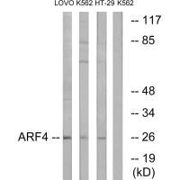 Western blot analysis of extracts from LOVO cells, K562 cells and HT-29 cells, using ARF4 antibody.