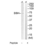 Western blot analysis of extracts from Jurkat cells, using DBH antibody.