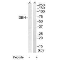 Western blot analysis of extracts from Jurkat cells, using DBH antibody.