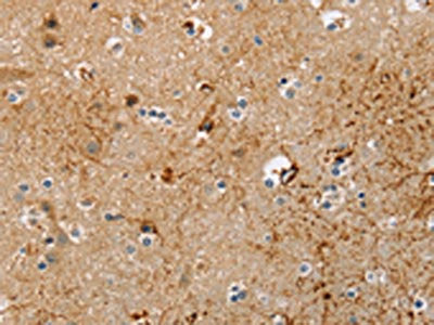 The image on the left is immunohistochemistry of paraffin-embedded Human brain tissue using CSB-PA093338(TRIM69 Antibody) at dilution 1/30, on the right is treated with fusion protein. (Original magnification: ×200)