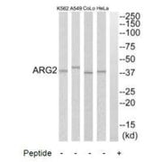 Western blot analysis of extracts from HeLa cells, A549 cells, COLO205 cells and K562 cells, using ARG2 antibody.