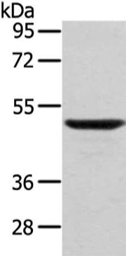 Gel: 8%SDS-PAGE, Lysate: 40 ug, Lane: Mouse lung tissue, Primary antibody: CSB-PA093442(WASF2 Antibody) at dilution 1/200 dilution, Secondary antibody: Goat anti rabbit IgG at 1/8000 dilution, Exposure time: 1 minute