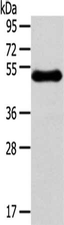 Gel: 8%SDS-PAGE,Lysate: 40 ug,,Primary antibody: CSB-PA093489(RHCE Antibody) at dilution 1/250 dilution,Secondary antibody: Goat anti rabbit IgG at 1/8000 dilution,Exposure time: 5 minutes