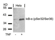 Western blot analysis of extracts from Hela cells untreated or treated with TNF using IkB-a(Phospho-Ser32/Ser36) Antibody.