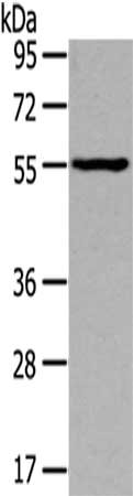 Gel: 8%SDS-PAGE,Lysate: 40 ug,,Primary antibody: CSB-PA093917(THRA Antibody) at dilution 1/400 dilution,Secondary antibody: Goat anti rabbit IgG at 1/8000 dilution,Exposure time: 1 minute