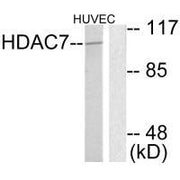 Western blot analysis of extracts from HuvEc cells, using HDAC7 antibody.