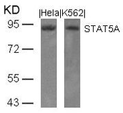 Western blot analysis of extracts from Hela and K562 cells using STAT5A(Ab-694) Antibody.