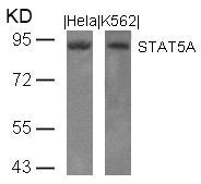 Western blot analysis of extracts from Hela and K562 cells using STAT5A(Ab-694) Antibody.