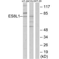Western blot analysis of extracts from COLO205 cells, using ES8L1 antibody.