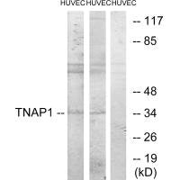Western blot analysis of extracts from HUVEC cells treated with PMA (125ng/ml, 30mins), and HUVEC cells treated with serum (20%, 30mins), using TNAP1 antibody.