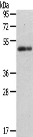 Gel: 8%SDS-PAGE,Lysate: 40 ug,,Primary antibody: CSB-PA094644(CCKBR Antibody) at dilution 1/200 dilution,Secondary antibody: Goat anti rabbit IgG at 1/8000 dilution,Exposure time: 40 seconds