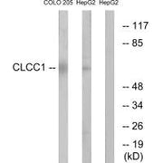 Western blot analysis of extracts from COLO cells and HepG2 cells, using CLCC1 antibody.